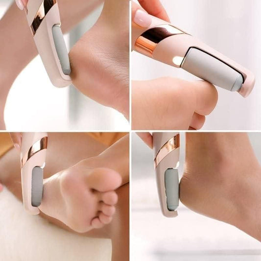 Electronic Callous Pedicure 2.0 - Flexyfi